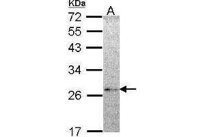 WB Image Sample (30 ug of whole cell lysate) A: Hela 12% SDS PAGE NME5 antibody antibody diluted at 1:1000 (NME5 抗体  (Center))
