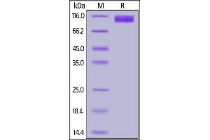 SARS S1 protein, His Tag on SDS-PAGE under reducing (R) condition.