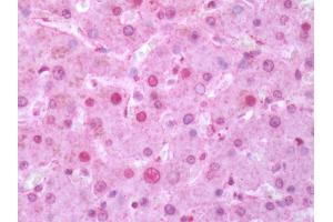 Human Liver: Formalin-Fixed, Paraffin-Embedded (FFPE) (RORC 抗体  (Ligand Binding Domain))