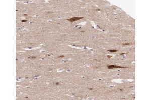 ABIN6267316 at 1/200 staining human brain tissue sections by IHC-P. (Retinoblastoma 1 抗体  (pSer795))
