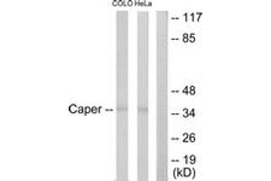 Western blot analysis of extracts from COLO205/HeLa cells, using Caper Antibody.