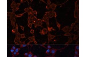 Immunofluorescence analysis of NIH/3T3 cells using SLC25A27 Polyclonal Antibody at dilution of 1:100. (SLC25A27 抗体)