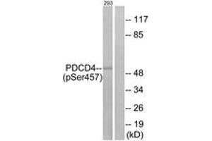 Western blot analysis of extracts from 293 cells treated with serum 20% 15', using PDCD4 (Phospho-Ser457) Antibody. (PDCD4 抗体  (pSer457))