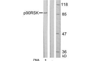 Image no. 1 for anti-Ribosomal Protein S6 Kinase, 90kDa, Polypeptide 1 (RPS6KA1) (Ser352) antibody (ABIN197330) (RPS6KA1 抗体  (Ser352))