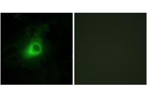 Immunofluorescence analysis of HeLa cells, using GRK6 Antibody. (GRK6 抗体  (AA 10-59))