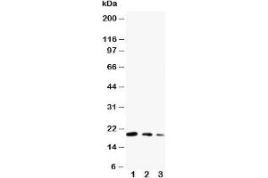 Western blot testing of CDC42 antibody and Lane 1:  ecombinant human protein 10ng;  2: 5ng;  3: 2. (CDC42 抗体  (Middle Region))