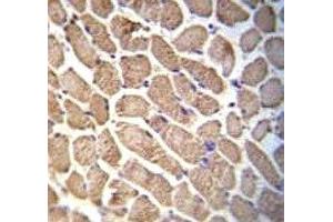 Hamartin antibody immunohistochemistry analysis in formalin fixed and paraffin embedded human skeletal muscle.