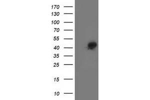 Western Blotting (WB) image for anti-Spermine Synthase, SMS (SMS) antibody (ABIN1501092) (SMS 抗体)
