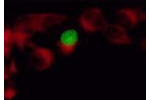 Immunofluorescence (IF) image for anti-Herpes Simplex Virus Type 1 ICP4 (HSV1 ICP4) antibody (ABIN265556) (HSV1 ICP4 抗体)