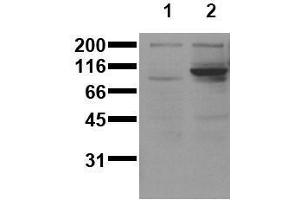 Western Blotting (WB) image for anti-Signal Transducer and Activator of Transcription 6, Interleukin-4 Induced (STAT6) (pTyr641) antibody (ABIN126901) (STAT6 抗体  (pTyr641))