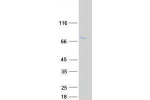 Western Blotting (WB) image for Tetratricopeptide Repeat Domain 30A (TTC30A) protein (Myc-DYKDDDDK Tag) (ABIN2734477)