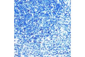 Immunohistochemistry of paraffin-embedded rat spleen using MCM3 Rabbit mAb (ABIN7268540) at dilution of 1:100 (40x lens). (MCM3 抗体)