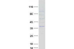 Western Blotting (WB) image for Nicotinamide Nucleotide Adenylyltransferase 2 (NMNAT2) (Transcript Variant 2) protein (Myc-DYKDDDDK Tag) (ABIN2727414)