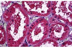 Human Kidney, Tubules: Formalin-Fixed, Paraffin-Embedded (FFPE) (Osteopontin 抗体)