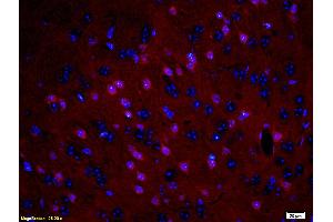 Formalin-fixed and paraffin embedded: rat brain tissue labeled with Anti-MBP Polyclonal Antibody (ABIN739400), Unconjugated at 1:200, followed by conjugation to the secondary antibody was Goat Anti-Rabbit IgG, PE conjugated at 1:200 for 40 minutes at 37°C DAPI(5 µg/ml, blue) was used to stain the cell nuclei (MBP 抗体  (AA 69-85))