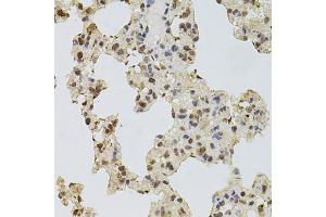 Immunohistochemistry of paraffin-embedded rat lung using EGFR antibody (ABIN5997646) at dilution of 1/100 (40x lens). (EGFR 抗体)