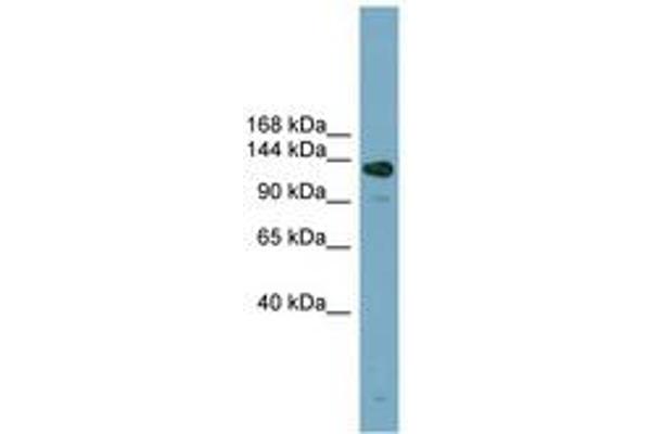 ASXL2 anticorps  (AA 575-624)