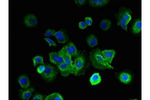 Immunofluorescent analysis of MCF-7 cells using ABIN7158190 at dilution of 1:100 and Alexa Fluor 488-congugated AffiniPure Goat Anti-Rabbit IgG(H+L) (LRRC4C 抗体  (AA 201-500))