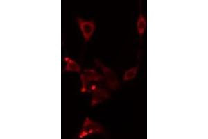 Immunofluorescence (fixed cells) (IF/ICC) image for anti-Cytochrome P450, Family 2, Subfamily E, Polypeptide 1 (CYP2E1) (Internal Region) antibody (ABIN6261170)