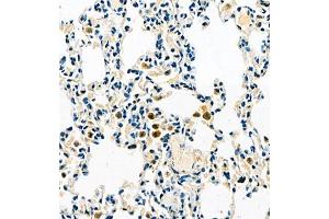 Immunohistochemistry of paraffin embedded rat lung using TMEM176A (ABIN7075995) at dilution of 1:500 (400x lens) (TMEM176A 抗体)