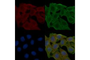 ABIN6258013 and ABIN6274979 staining Hela cells(24h of starvation treatment) by IF/ICC. (CDC42EP2 抗体  (N-Term))