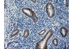 Image no. 2 for anti-Pyridoxal Kinase (PDXK) antibody (ABIN1500145) (PDXK 抗体)