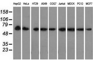 Western blot analysis of extracts (35 µg) from 9 different cell lines by using anti-PEX5 monoclonal antibody. (PEX5 抗体)