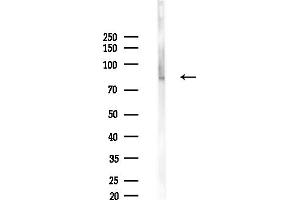 anti-Zinc Finger Protein 750 (ZNF750) (N-Term) antibody