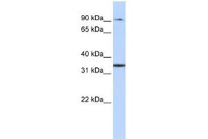 ZFP90 antibody used at 0. (ZNF90 抗体  (Middle Region))