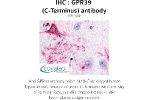 Image no. 1 for anti-G Protein-Coupled Receptor 39 (GPR39) (C-Term) antibody (ABIN1735081) (GPR39 抗体  (C-Term))