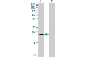Western Blot analysis of SUMO3 expression in transfected 293T cell line by SUMO3 monoclonal antibody (M08), clone 4G11.