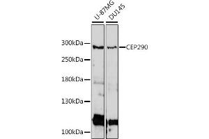Western blot analysis of extracts of various cell lines, using CEP290 antibody (ABIN7266277) at 1:1000 dilution. (CEP290 抗体  (AA 950-1050))