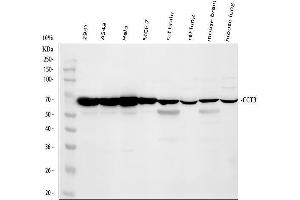 Western blot analysis of CCT3 using anti-CCT3 antibody (ABIN4886513).