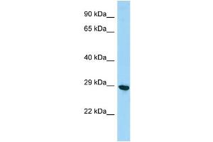 Host:  Rabbit  Target Name:  Phf7  Sample Type:  Mouse Testis lysates  Antibody Dilution:  1. (PHF7 抗体  (C-Term))
