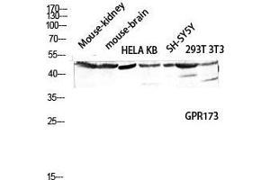 Western Blot (WB) analysis of Mouse Kidney Mouse Brain HeLa KB SH-SY5Y 293T 3T3 lysis using GPR173 antibody. (GPR173 抗体  (Internal Region))