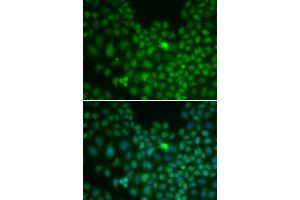 Immunofluorescence analysis of U2OS cells using Clusterin alpha chain antibody (ABIN6133478, ABIN6138757, ABIN6138759 and ABIN6217494). (Clusterin 抗体  (AA 220-449))