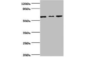 Western blot All lanes: MAPK4 ntibody at 6 μg/mL Lane 1: Mouse brain tissue Lane 2: 293T whole cell lysate Lane 3: Jurkat whole cell lysate Secondary Goat polyclonal to rabbit IgG at 1/10000 dilution Predicted band size: 66 kDa Observed band size: 66 kDa (MAPK4 抗体  (AA 348-587))