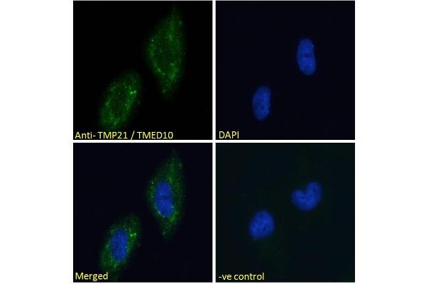 TMED10 抗体  (C-Term)