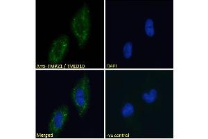 ABIN190858 Immunofluorescence analysis of paraformaldehyde fixed U251 cells, permeabilized with 0. (TMED10 抗体  (C-Term))