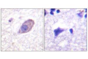 Immunohistochemistry (IHC) image for anti-Potassium Inwardly-Rectifying Channel, Subfamily J, Member 16 (KCNJ16) (Ser416) antibody (ABIN1848056) (KIR5.1 抗体  (Ser416))