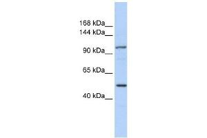 KIAA1618 antibody used at 5 ug/ml to detect target protein. (RNF213 抗体  (N-Term))