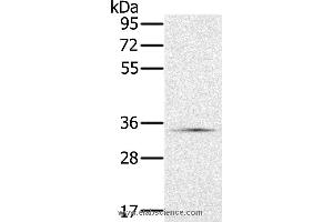 Western blot analysis of Hela cell, using NDUFA9 Polyclonal Antibody at dilution of 1:400 (NDUFA9 抗体)