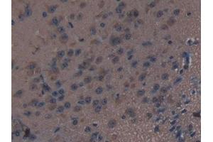 Detection of THBS1 in Mouse Brain Tissue using Polyclonal Antibody to Thrombospondin 1 (THBS1) (Thrombospondin 1 抗体  (AA 61-259))