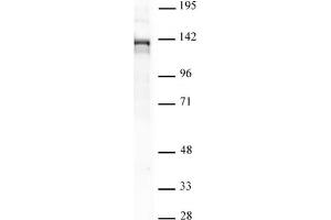 PHF8 pAb tested by Western blot. (PHF8 抗体)