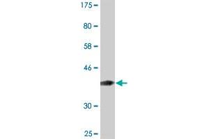 Western Blot detection against Immunogen (36. (MTA1 抗体  (AA 601-700))