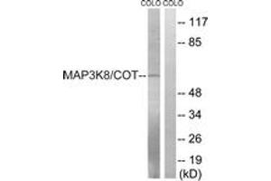 Western blot analysis of extracts from COLO205 cells, treated with Insulin 0. (MAP3K8 抗体  (AA 366-415))