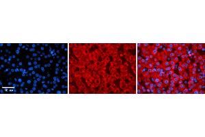 Rabbit Anti-ZYX Antibody    Formalin Fixed Paraffin Embedded Tissue: Human Adult liver  Observed Staining: Cytoplasmic Primary Antibody Concentration: 1:600 Secondary Antibody: Donkey anti-Rabbit-Cy2/3 Secondary Antibody Concentration: 1:200 Magnification: 20X Exposure Time: 0.