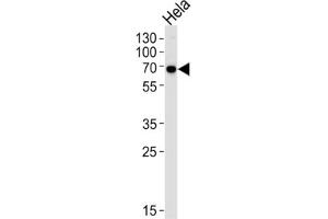 Western Blotting (WB) image for anti-Kinesin Light Chain 1 (KLC1) antibody (ABIN3003845) (KLC1 抗体)