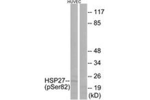 Western blot analysis of extracts from HuvEc cells treated with TNF 20ng/ml 30', using HSP27 (Phospho-Ser82) Antibody. (HSP27 抗体  (pSer82))
