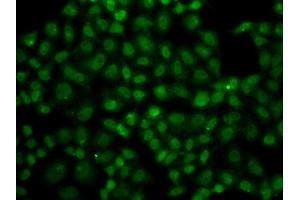 Immunofluorescence analysis of A549 cell using USP26 antibody. (USP26 抗体)